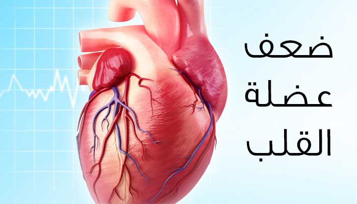 علامات ضعف القلب , اعراض اعتلال عضلة القلب