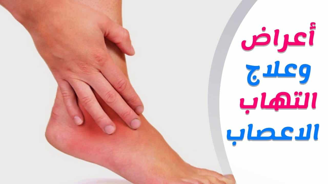 تشنج الاعصاب اثناء النوم - اسباب تشنج الاعصاب اثناء النوم 13109 2