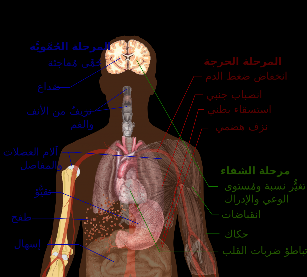 ما معنى الحمى , اعراض الحمى