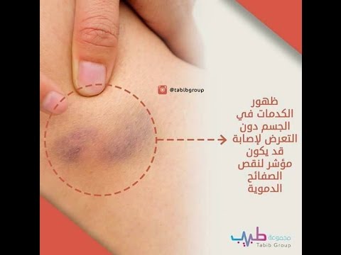 معلومات طبية , اجمل وافيد المعلومات الماخذوة من الاطباء