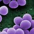 18064 1 معلومات عن البكتيريا العقدية - نبذه بسيطه عن هذه البكتيريا عتاب يونس