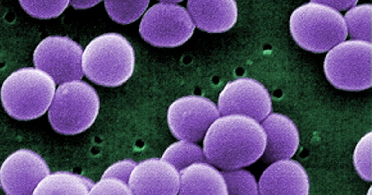 18064 معلومات عن البكتيريا العقدية - نبذه بسيطه عن هذه البكتيريا عتاب يونس